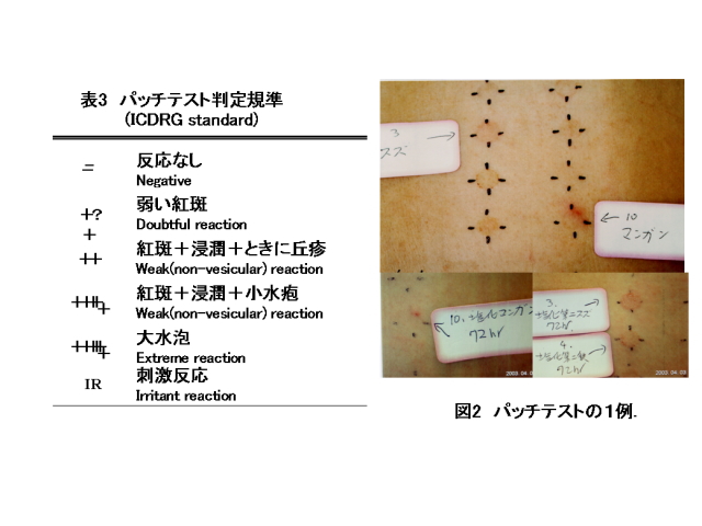 パッチテスト判定基準と１例